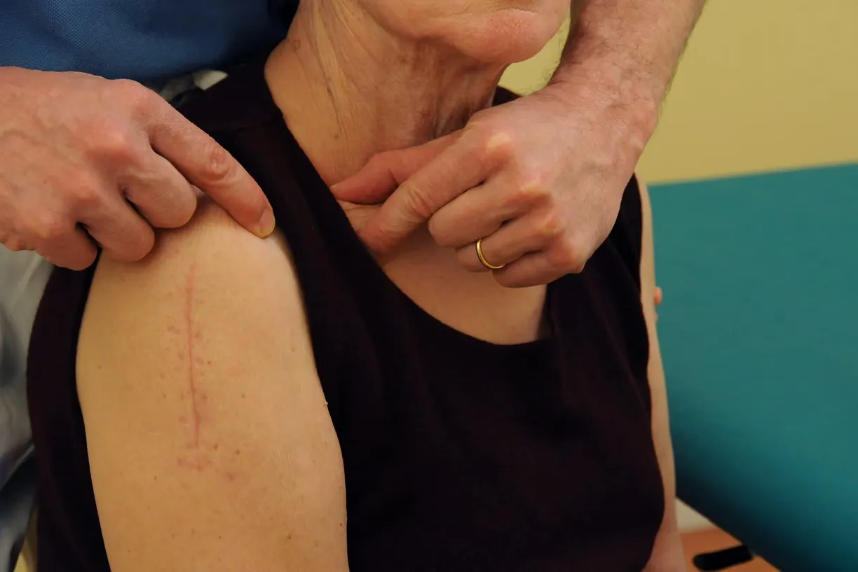 Mano adulta che indica una cicatrice su braccio di una donna anziana con maglietta scura.